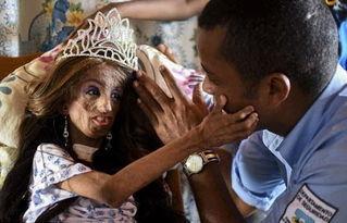 衰老症图片,图片中的岁月痕迹与抗衰老探索